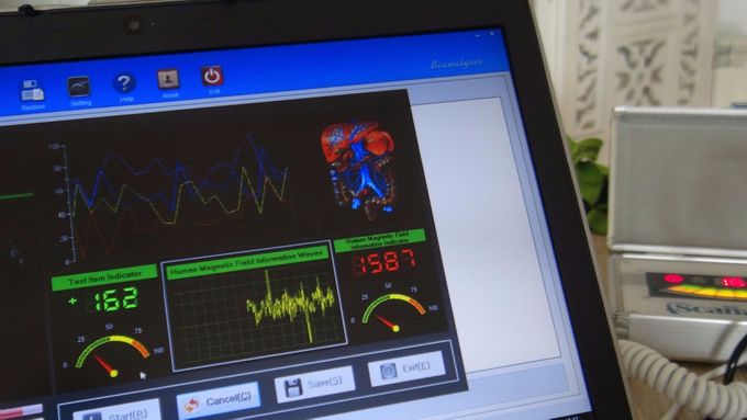 BioScan scanner din krop for ubalancer